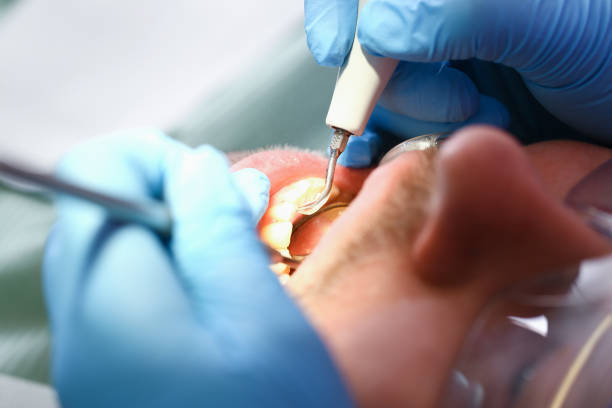 Best Emergency Treatment for Toothache in Genola, UT