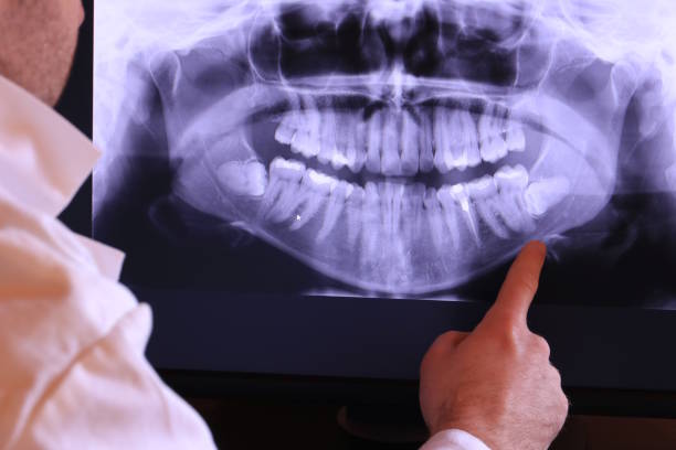 Best Emergency Broken Tooth Repair in Genola, UT